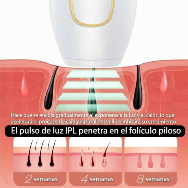 Depiladora Laser IPL