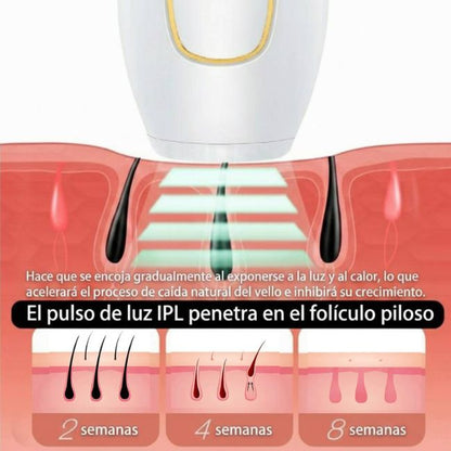 Depiladora Laser IPL